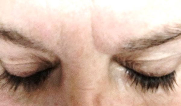 closeup of eyelashes after using Latisse
