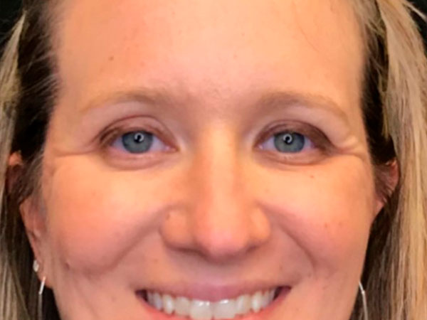 close up of woman smiling after using skincare